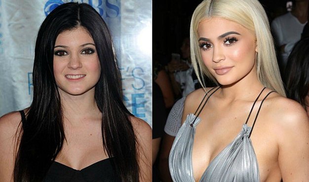 Kylie Jenner revela cuántas cirugías se ha realizado ?