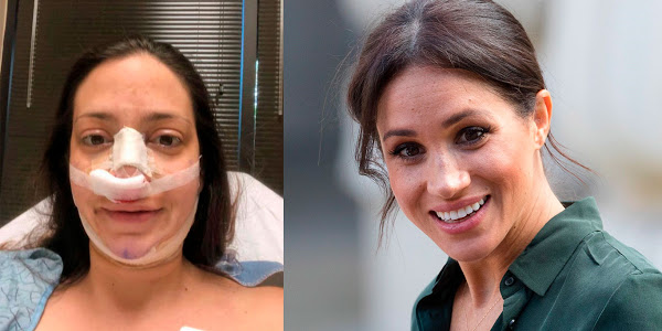 Esta mujer gastó 30.000 dólares para parecerse a Meghan Markle [FOTO] ??