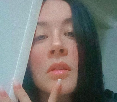 ¡Epaaa! Diosa Canales mostró los chupones que le hicieron en zonas sensibles del cuerpo [FOTO]