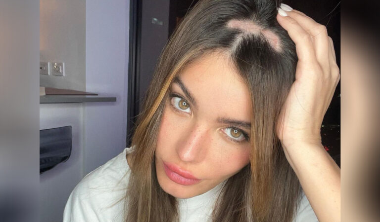 Aleska Génesis se quitó la peluca en redes sociales