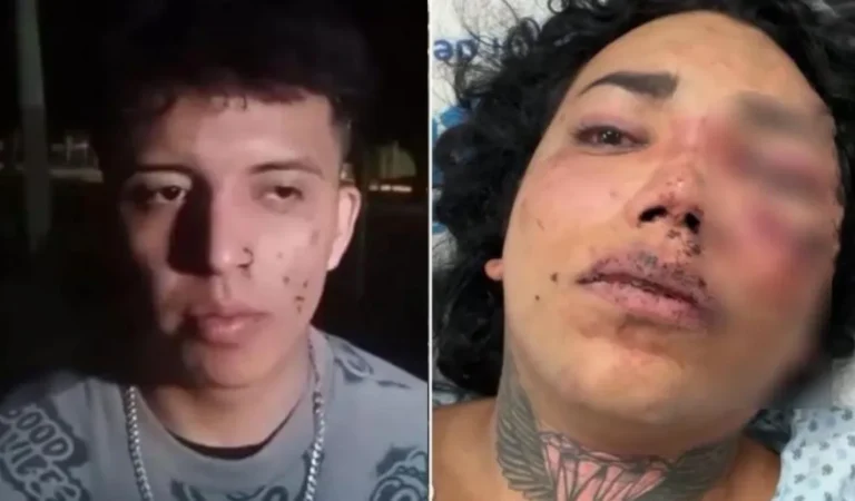 «No me estoy escondiendo»: Apareció el agresor de Paola Suárez