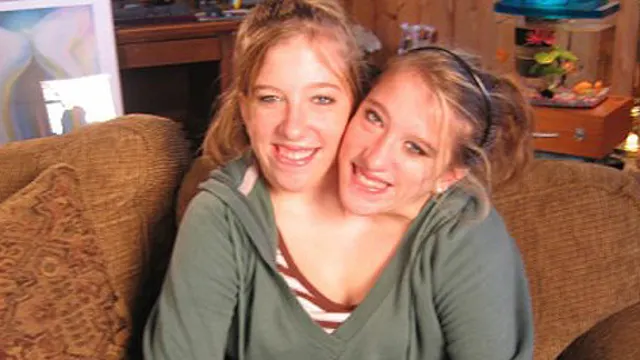 ¡Omg! Abby Hensel enloqueció las redes al confesar que se casó en total hermetismo