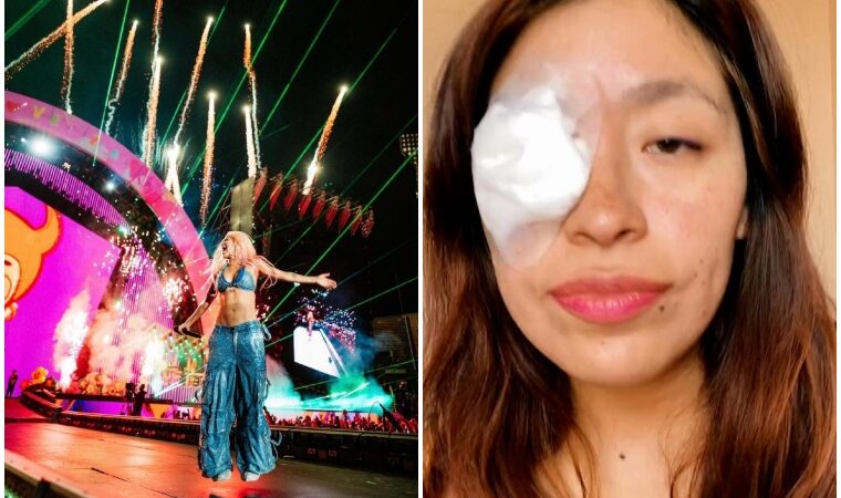 Fanática de Karol G sufre un accidente por pirotecnia en su concierto