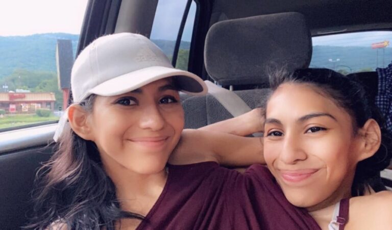 Las siamesas Andrade son virales por revelar detalles sobre su condición